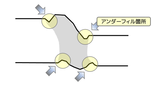 アンダーフィル（ヒケ）